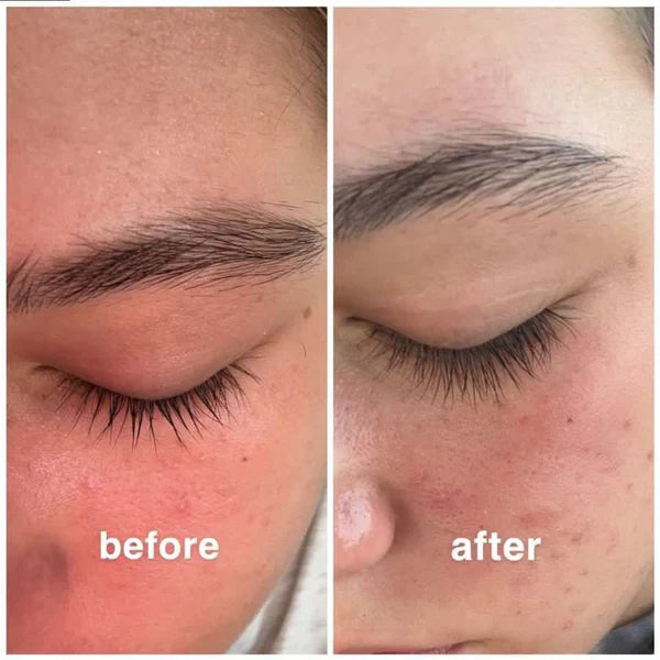 Eyelashes Growth Serum